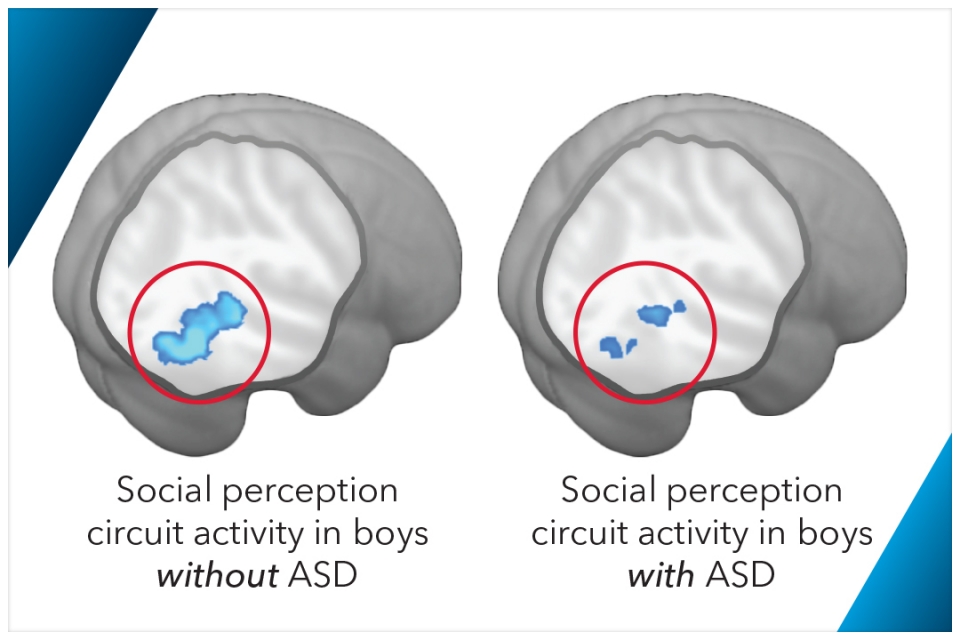 Autism brain imaging in boys